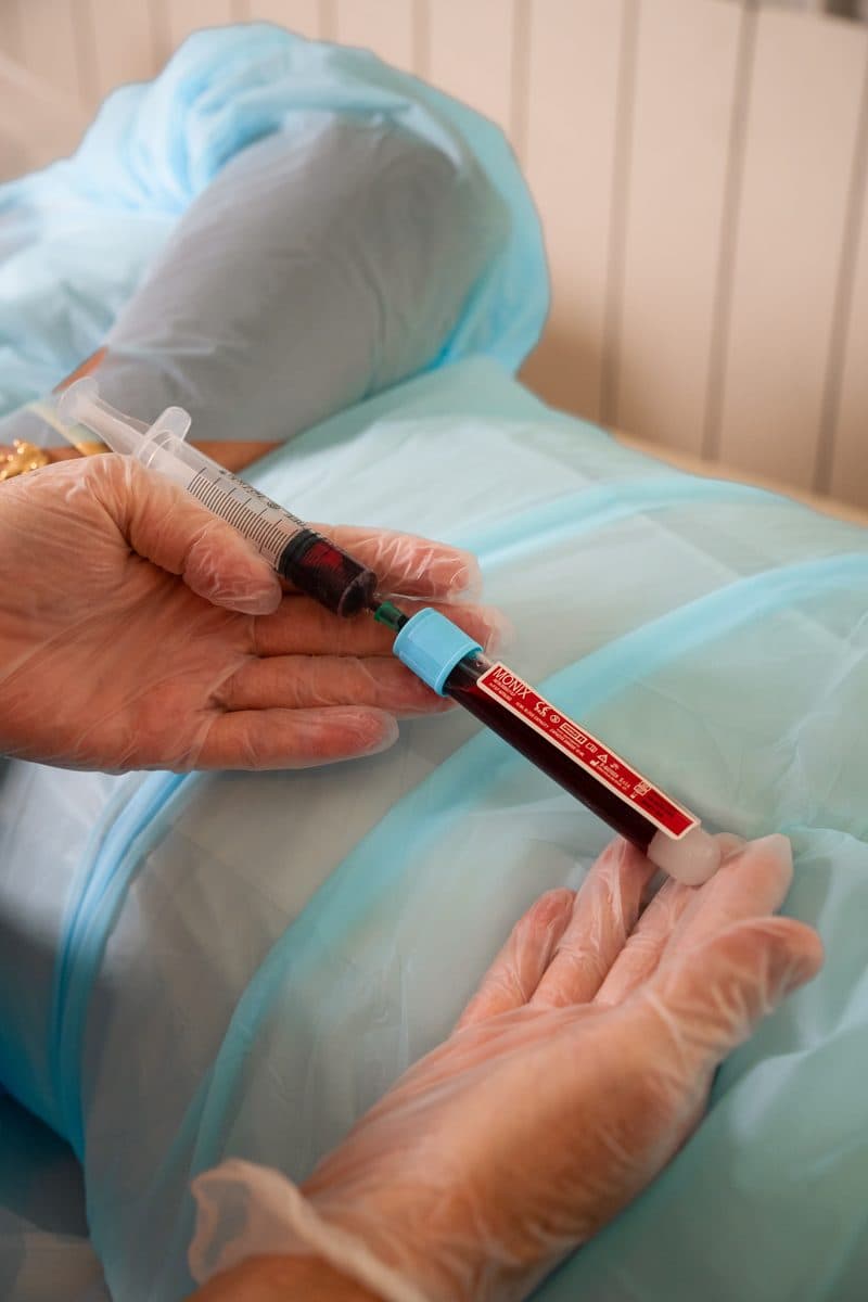 Prelievo del sangue per terapia autologa PRP