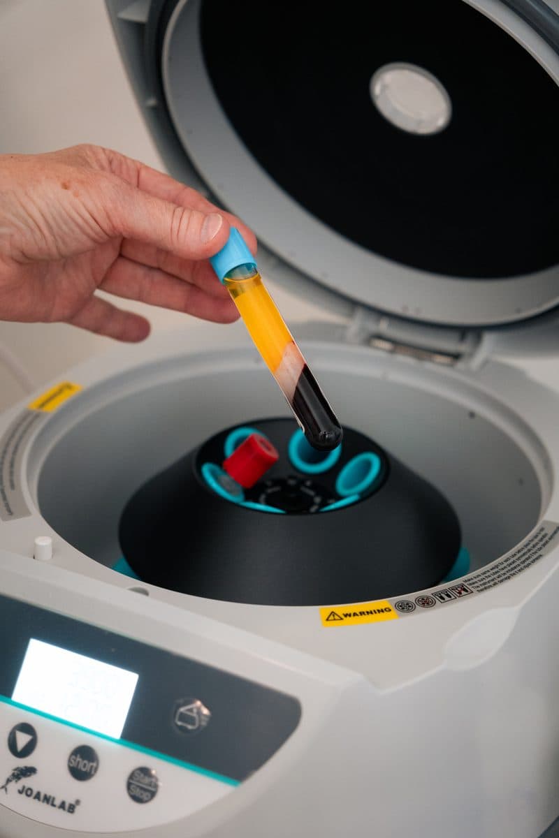 Centrifuga per la preparazione del PRP