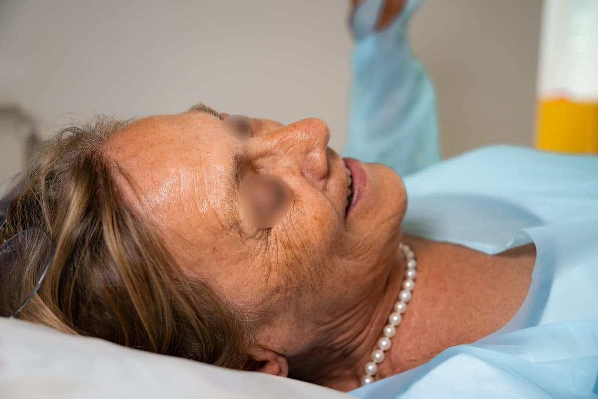Trattamento rigenerativo viso con PRP
